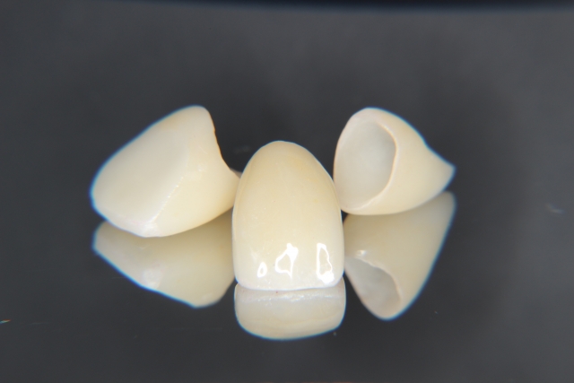 セラミック治療で生まれつきの歯のような透明感を