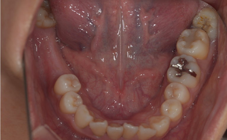 テキストテキストテキスト