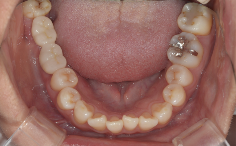 テキストテキストテキスト