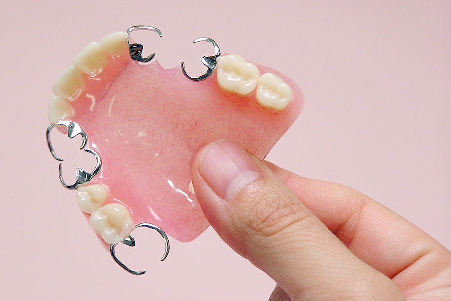 失われた機能と自信を取り戻す「入れ歯」という選択肢