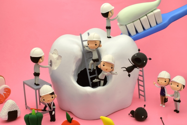 ダイレクトボンディングとは